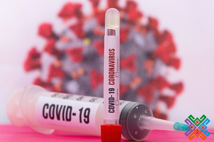 Оперативна інформація про поширення COVID-19 в Хмельницькій області