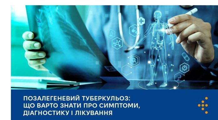 Позалегеневий туберкульоз: що варто знати про симптоми, діагностику і лікування