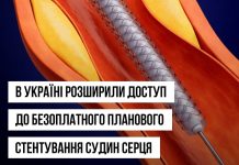Пацієнти із хронічними коронарними синдромами зможуть безоплатно отримати послугу із планового стентування судин