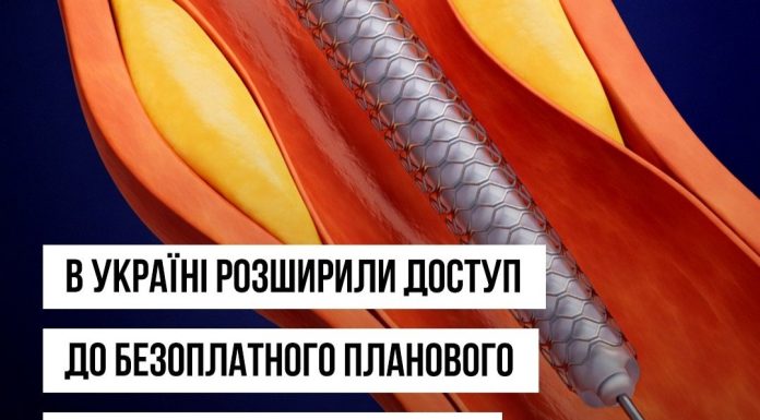 Пацієнти із хронічними коронарними синдромами зможуть безоплатно отримати послугу із планового стентування судин