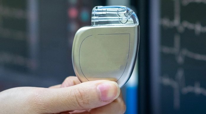 Імплантація та заміна електрокардіостимулятора в Україні є безоплатними для пацієнта в межах Програми медичних гарантій